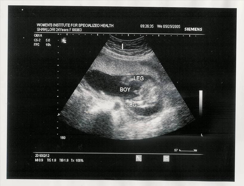 Baby20Weeks00001.jpg