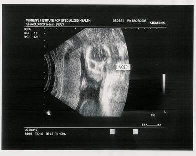 Baby20Weeks00003.jpg